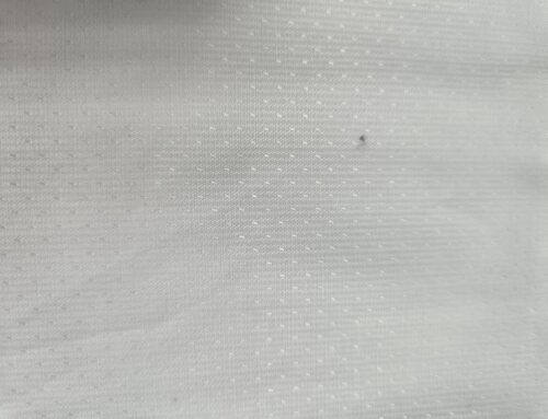 Understanding Pigment Spots in Light-Colored Fabrics